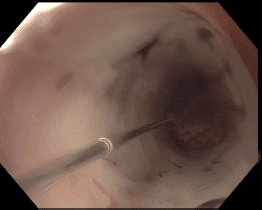 Elation5案例研究