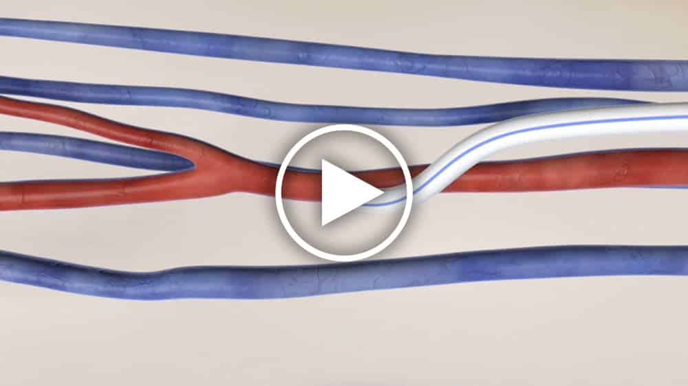 Patienten和贪污funktioniert Betreuer——体育英雄