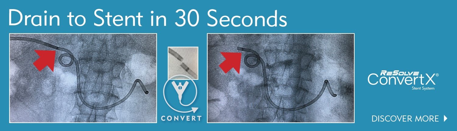 解决ConvertX  - 排水到支架在30秒内