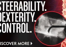 稳定性MX -操纵性，灵活性，控制-优点医疗-椎体增强