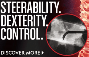 StabiliT MX -可操纵性,灵巧,控制-绩效医疗椎增大
