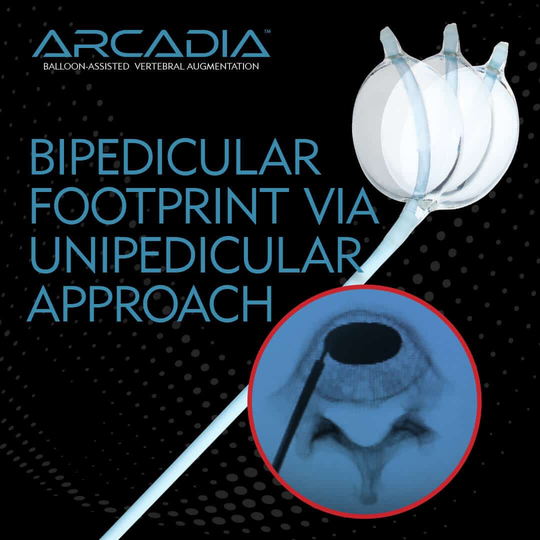 Arcadia  - 通过无秘密访问的双细化脚印 -  Merit Medical