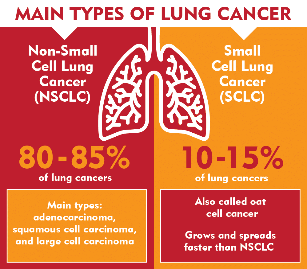 肺癌的主要类型-非小细胞肺癌和小细胞肺癌-优点医学
