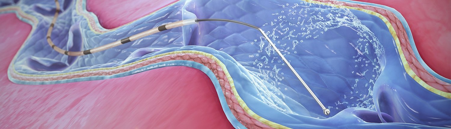 静脉的解决方案