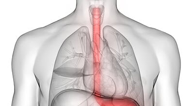 Behandlung von Lungenstrikturen - fallstuddie 1 -优点内窥镜