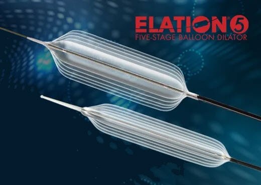 elation5  - 扩张reimagined