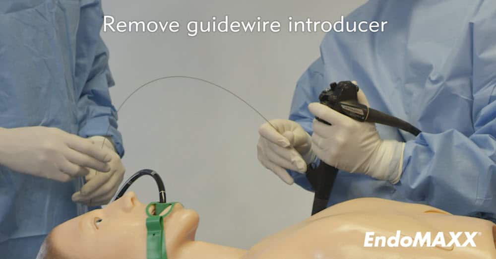 食管支架部署系统