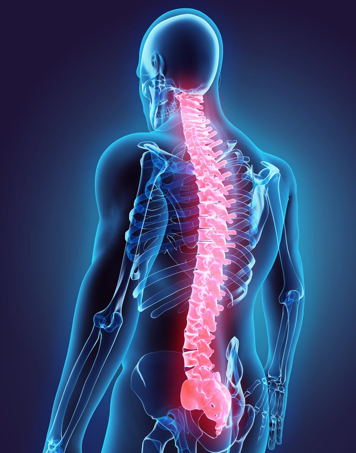 Vertebral Augmentation for Vertebral Compression Fractures (VCF)