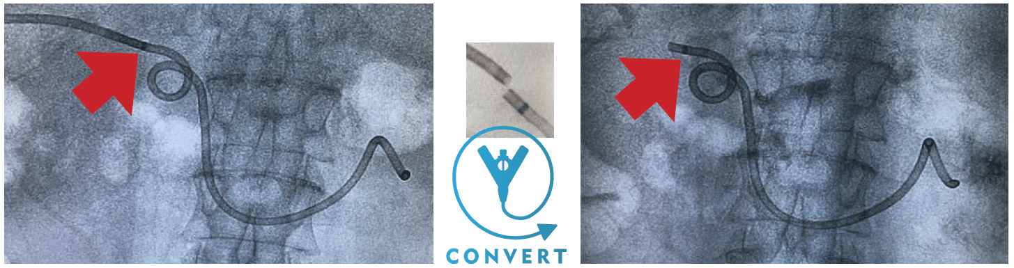 解析convertx-支架以排水转换
