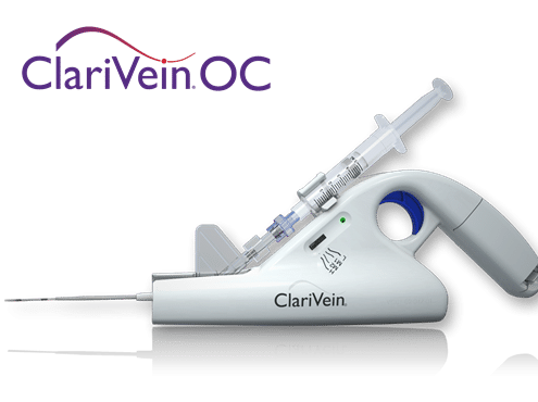 ClariVein OC -治疗静脉内机械化学消融