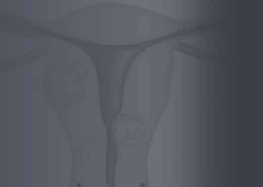 子宫肌瘤-肌瘤宣传月- 7月