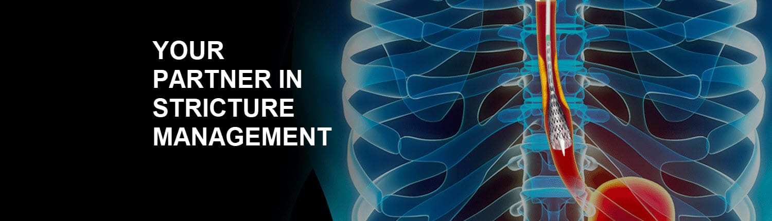 胃肠道狭窄处理-食管图像，支架向下延伸